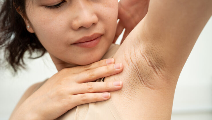 Beslenme alışkanlıkları ter kokusunu etkiliyor