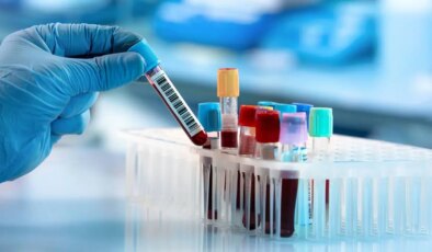 Bilimden çığır açan kanser tedavisi: Basit kan testi erken müdahaleyi kolaylaştırıyor