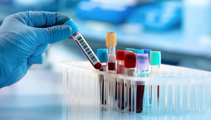 Bilimden çığır açan kanser tedavisi: Basit kan testi erken müdahaleyi kolaylaştırıyor