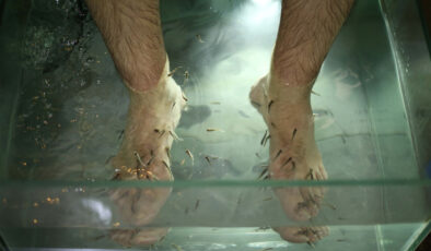 Bu mucizevi balıklar cilt sağlığına iyi geliyor