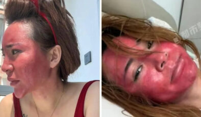 Çin’de yıllarca makyajını silmeden uyuyan kadın sağlığından oldu