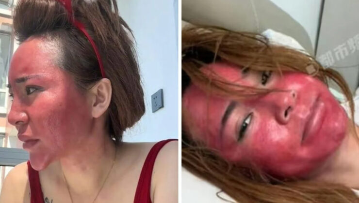 Çin’de yıllarca makyajını silmeden uyuyan kadın sağlığından oldu