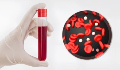 Dünyada sadece bir kişide bulunan yeni bir kan grubu keşfedildi