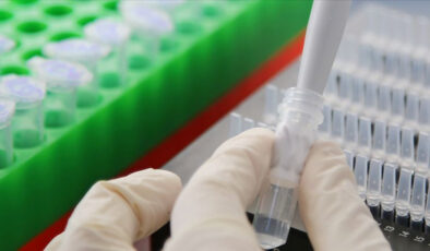 Fermuar aksamları ve kimyasallar için ithalat tarifesi belirlendi