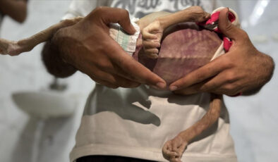 Gazze Şeridi’nde 24 saatte 1’i çocuk 14 Filistinli açlıktan hayatını kaybetti