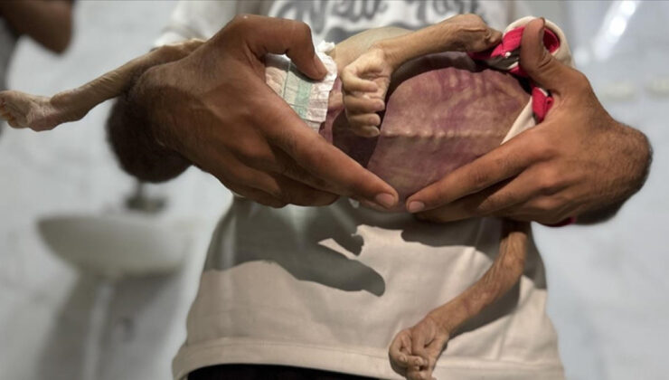 Gazze Şeridi’nde 24 saatte 1’i çocuk 14 Filistinli açlıktan hayatını kaybetti