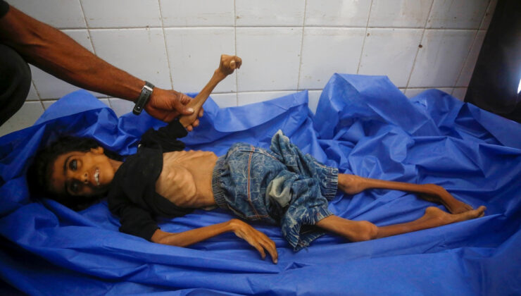 Gazze’de bir çocuk daha açlıktan öldü