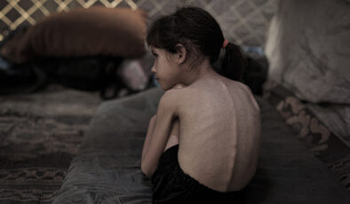 Gazze’de çocuklar açlık ve hastalıkla mücadele ediyor