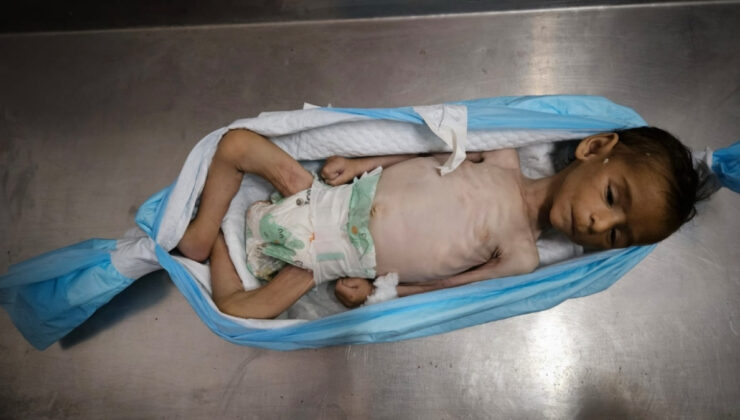Gazze’de iki bebek daha açlığa yenik düştü