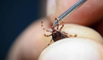 Hastaneye gitti… Karnına yapışan kene ile karşılaştı!