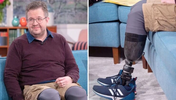 İngiliz cerraha çarpıcı suçlamalar: Bacaklarını kestirdi, başkalarını da teşvik etti