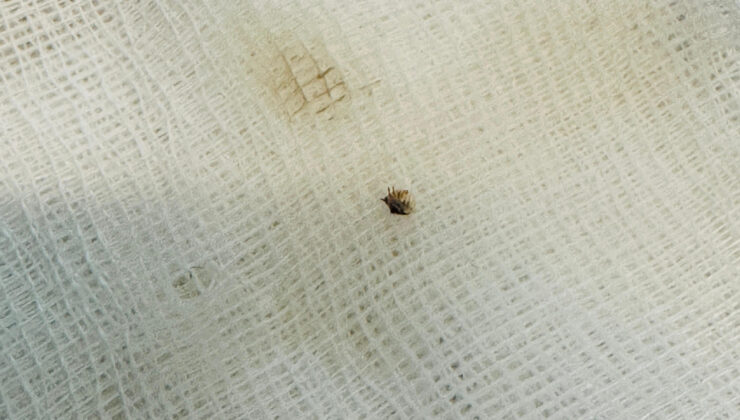 Kahramanmaraş’ta halsizlik nedeniyle hastaneye gitti: Karnına yapışan kene bulundu