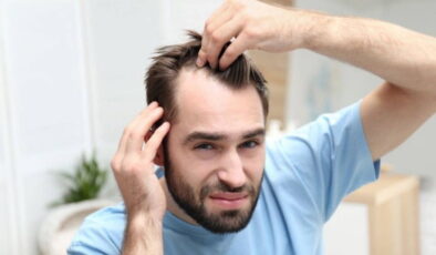 Saç dökülmesine karşı devrim yaratacak çözüm: Ne ilaç ne saç ekimi gerekiyor