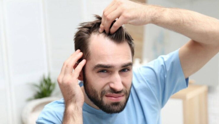 Saç dökülmesine karşı devrim yaratacak çözüm: Ne ilaç ne saç ekimi gerekiyor