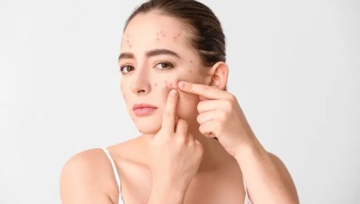 Temizlik ve nemlendirme rutininiz cilt sağlığınızı bozuyor olabilir: Akneye yol açan 7 cilt bakım hatası