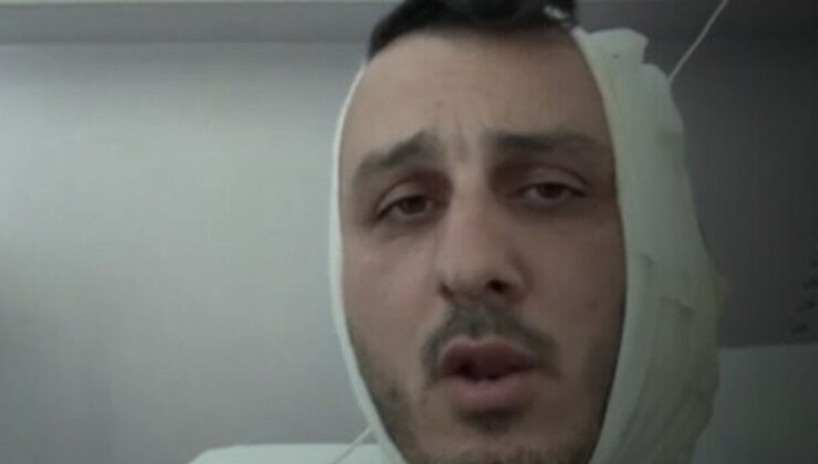 Yunanistan’a tatile giden İsrailli’ye saldırı: Kulağını kopardı