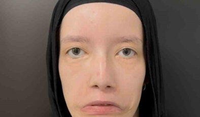 23 Yılı Mimiksiz Geçirdi: Türk Doktorların Operasyonuyla İlk Kez Gülümsedi