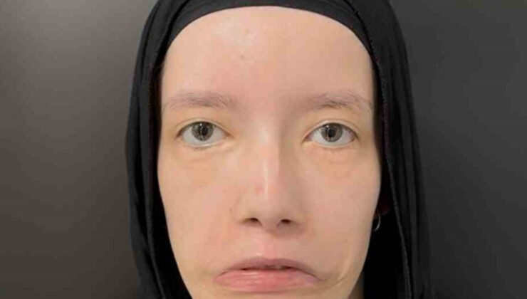 23 Yılı Mimiksiz Geçirdi: Türk Doktorların Operasyonuyla İlk Kez Gülümsedi