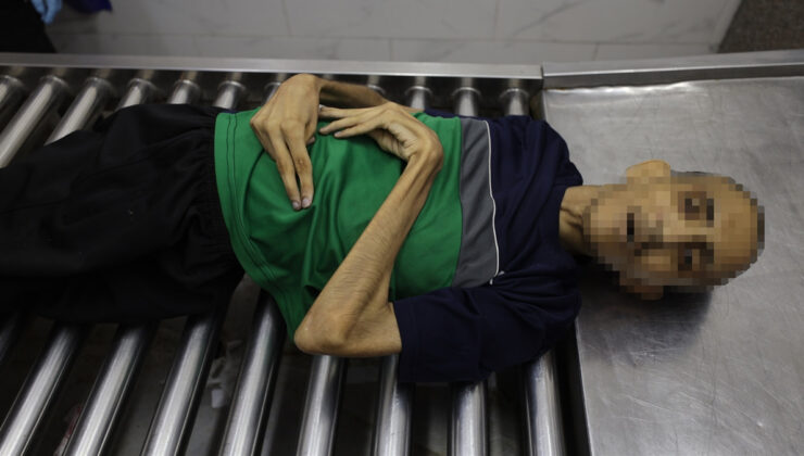 ABD: BM’nin ‘Gazze’de kıtlık var’ raporu dürüst değil