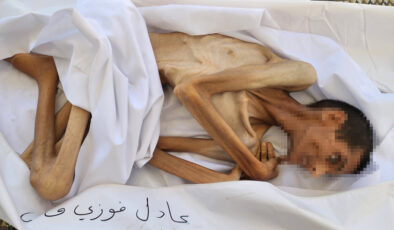 Açlık Gazze’de çocuk ve gençlerin kabusu oldu