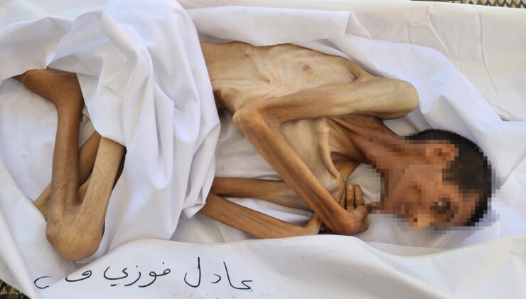 Açlık Gazze’de çocuk ve gençlerin kabusu oldu