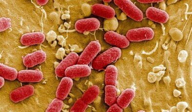 Bilim insanları uyarıyor: Et yiyen bakteri vakaları artıyor