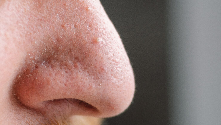 Burun kıllarını asla kökten almayın: Hayati tehlike oluşturuyor