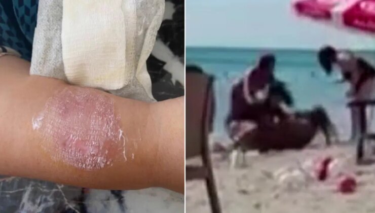 Büyükçekmece’de sigara dumanı tartışmasında kolunu ısırdı