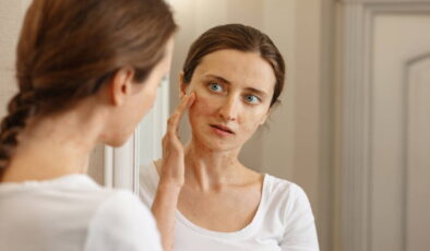 Cildinizdeki ton ve renk eşitsizliğinin sebebi bu rahatsızlık olabilir: Yaz mantarı ve sık karşılaşılan 5 belirtisi