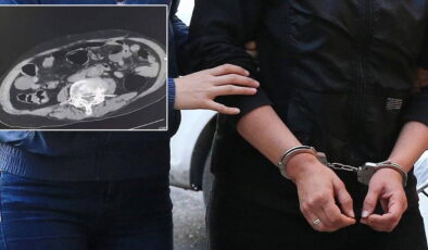 Cinsel organında uyuşturucu taşırken yakalandı!