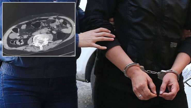 Cinsel organında uyuşturucu taşırken yakalandı!