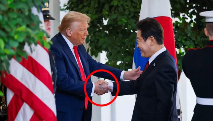 Donald Trump’ın eli neden morardı? İşte sebebi