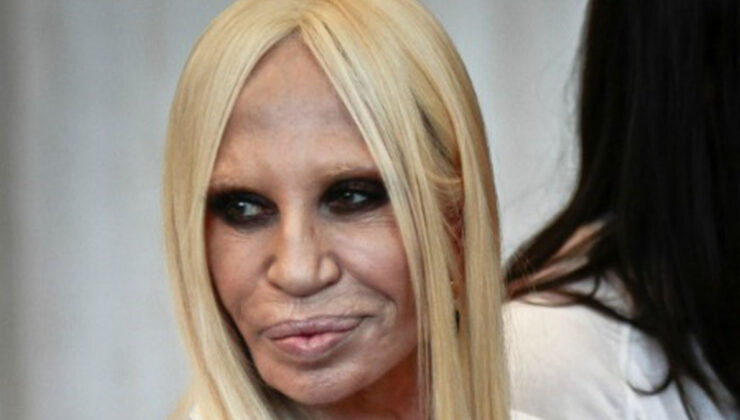 “Estetik kurbanı” olmuştu: İşte Versace’nin son hali