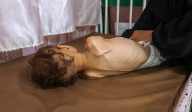 Gazze’de 11 kişi daha açlıktan hayatını kaybetti