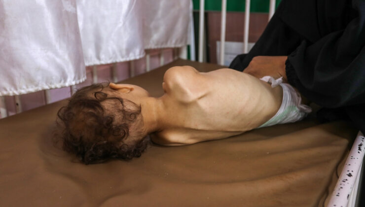 Gazze’de 11 kişi daha açlıktan hayatını kaybetti