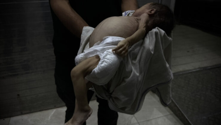 Gazze’de 2 aylık Rasil bebek, açlık sebebiyle hayatını kaybetti