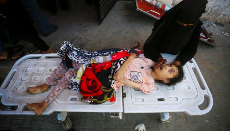 Gazze’de 20 yaşındaki Filistinli Şeyma El Eşrem açlık nedeniye hayatını kaybetti