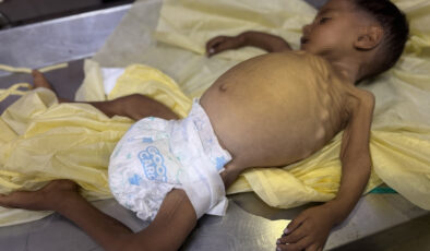 Gazze’de 4 kişi daha açlıktan hayatını kaybetti