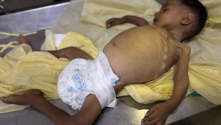 Gazze’de 4 kişi daha açlıktan hayatını kaybetti