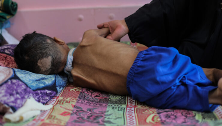 Gazze’de 5 Filistinli daha açlıktan hayatını kaybetti