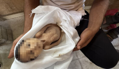 Gazze’de açlık: Bir bebek daha yetersiz beslenme nedeniyle hayatını kaybetti