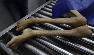 Gazze’de açlık krizi: 24 saatte 10 kişi hayatını kaybetti