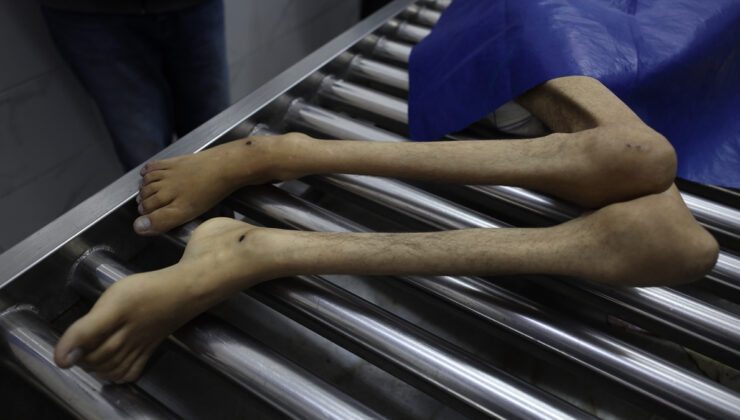 Gazze’de açlık krizi: 24 saatte 10 kişi hayatını kaybetti