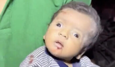 Gazze’de enkazdan çıkarılan bebek, şokun etkisiyle ağlayamadı