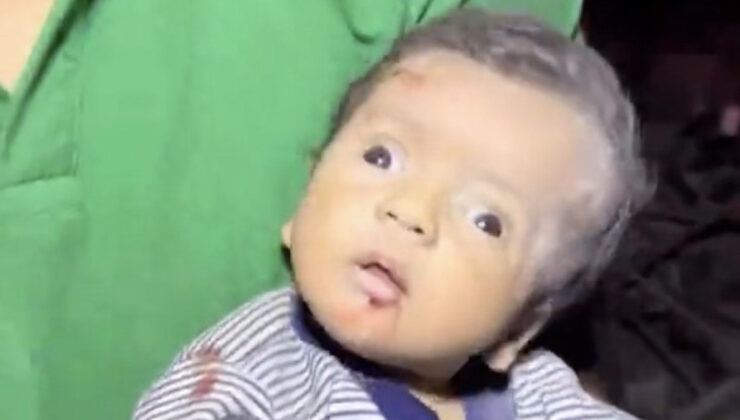 Gazze’de enkazdan çıkarılan bebek, şokun etkisiyle ağlayamadı