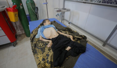 Gazze’de felaket devam ediyor: Felçli genç yetersiz beslenmeden yaşamını yitirdi