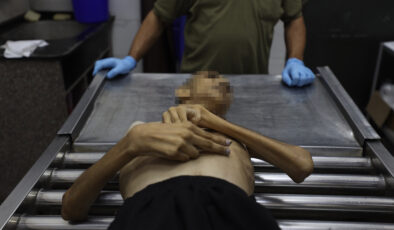 Gazze’de gıda krizi: Son 3 haftada bin yetişkin yetersiz beslenme nedeniyle hastaneye başvurdu