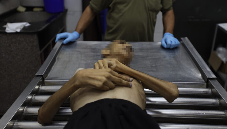 Gazze’de gıda krizi: Son 3 haftada bin yetişkin yetersiz beslenme nedeniyle hastaneye başvurdu