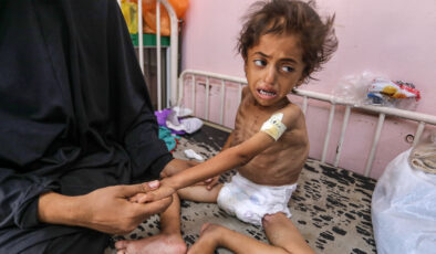 Gazze’de kıtlık can almaya devam ediyor: Çocuklar ölüm tehlikesi altında