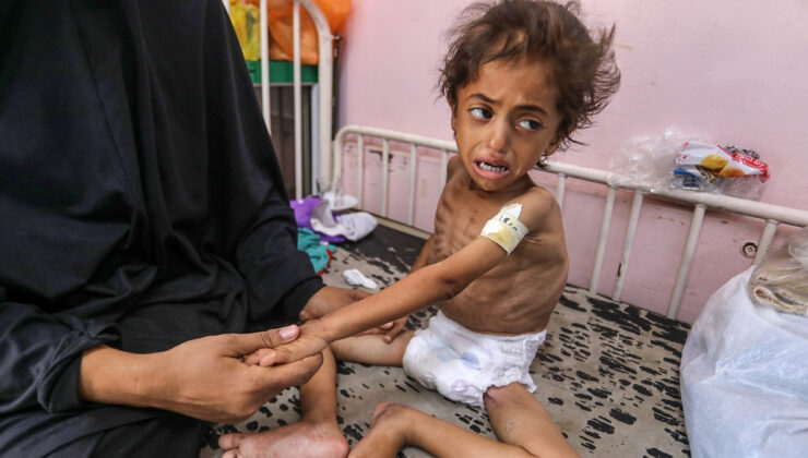 Gazze’de kıtlık can almaya devam ediyor: Çocuklar ölüm tehlikesi altında